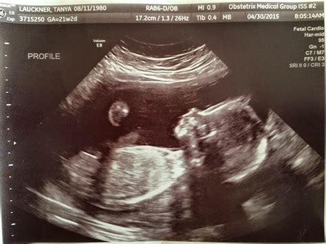 dating ultrasound at 20 weeks